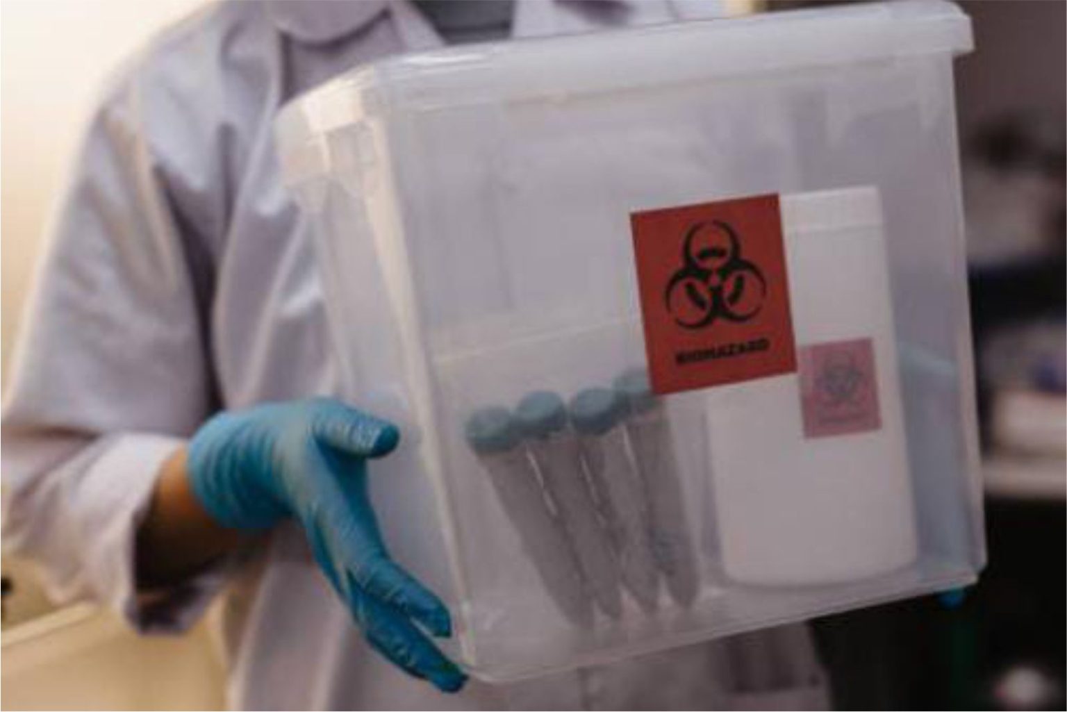 Technician handling a biohazard-labelled clinical trial sample kit